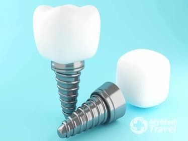 Compare Reviews, Prices & Costs of Invisalign in Singapore at Pristine Dentalworks - Dental Specialist Singapore | 0A6831