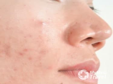 Slender Slimming & Skincare, Ladprao 101