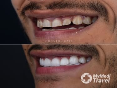 Odontoliuzzi Brazilian Dental Clinic with Excellence