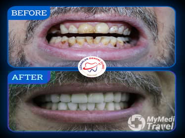 UZMANLAR Dental Clinic