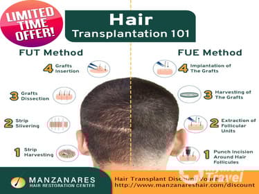 Compare Reviews, Prices & Costs of Wisdom Tooth Extraction in Davao del Sur at Manzanares Hair Restoration Center | 7A7065