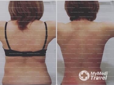 Compare Reviews, Prices & Costs of Dermal Fillers in Vietnam at Natural Aesthetics Plastic Surgery | A56BB9