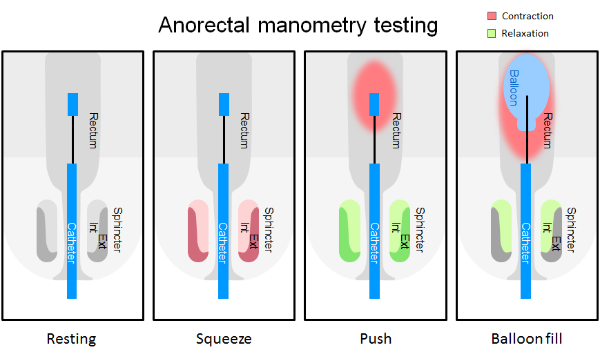 10 Best Clinics for Anorectal Manometry in India [2022 Prices]
